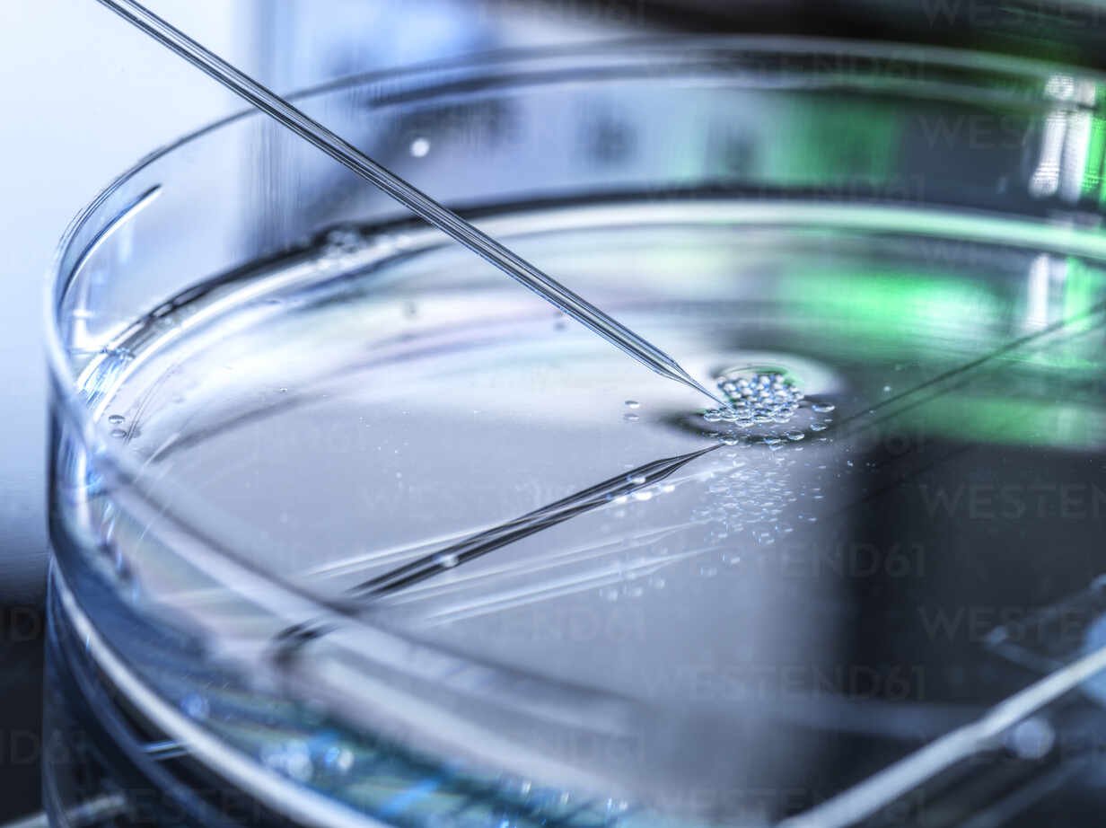 Patenting Embryonic Stem Cell Related Inventions in India
